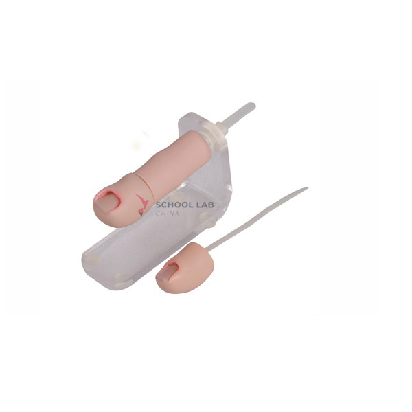 Nail Extraction Exercise Model