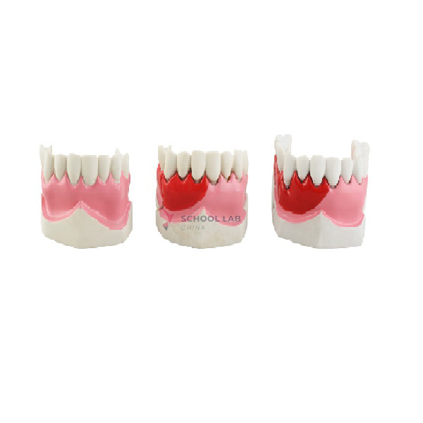 Periodontitis Model